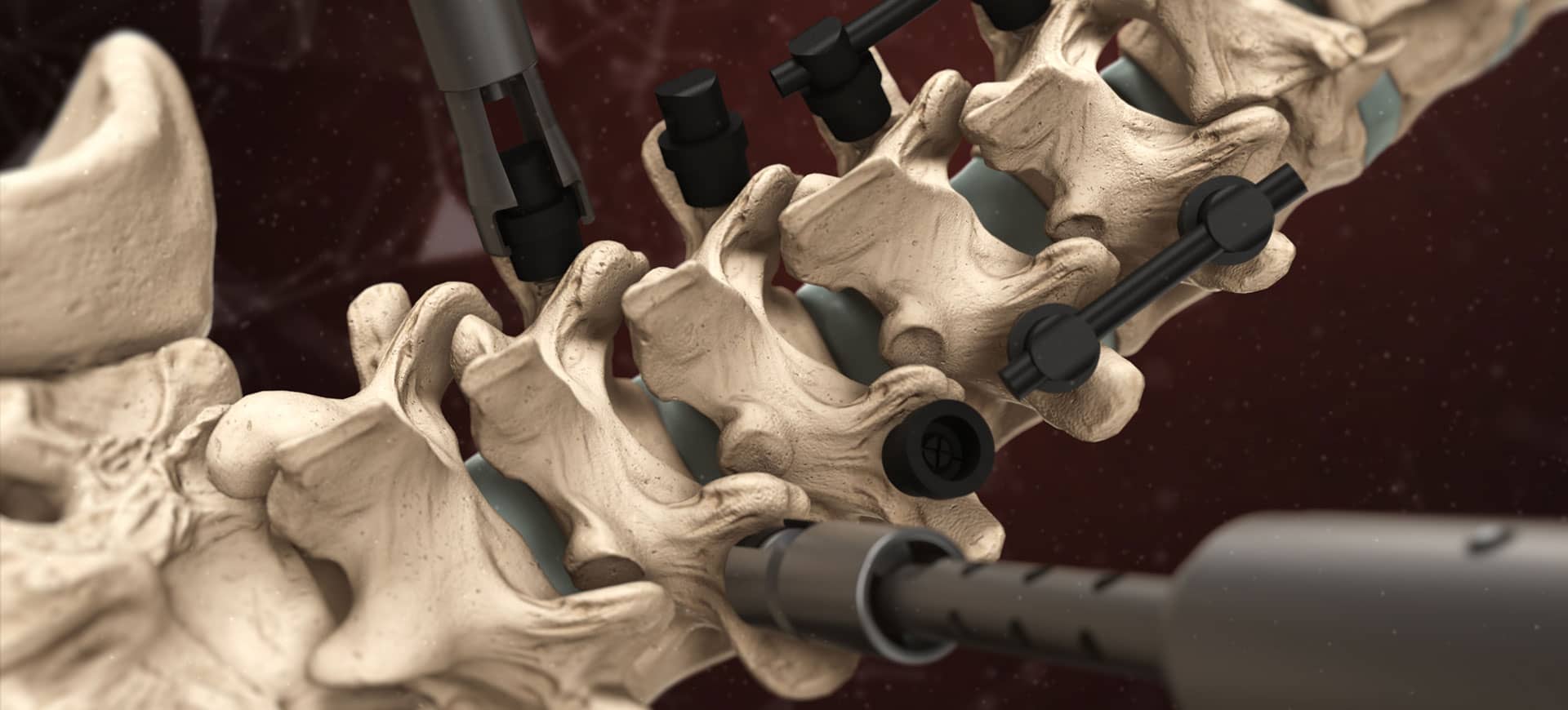 MVR Medical Animation - Medical Animations | Industrial Animations ...