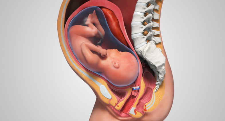 pregnantech Medical Animation
