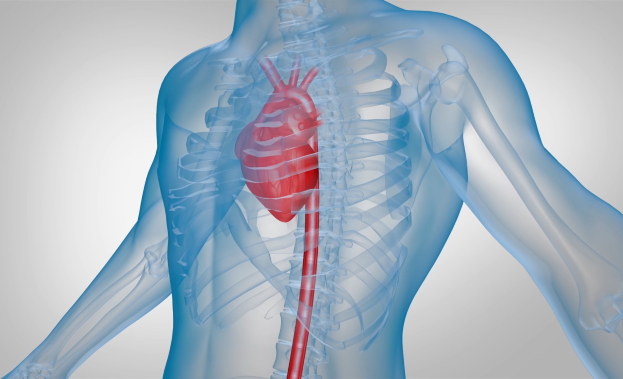 Keystone Heart Medical Animations