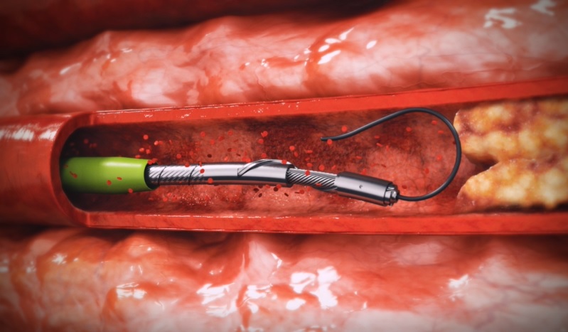 Plus Medical Animation
