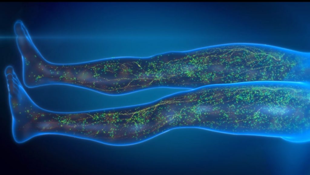 Mego Afek Medical Animation