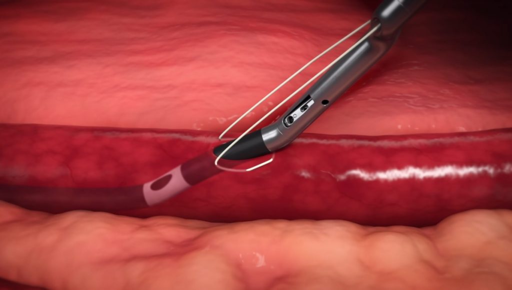 Medical Animation Novelrad