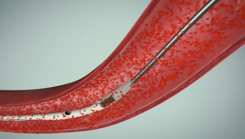 Medyria Medical Animations